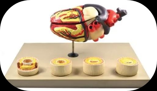 eisco® model of human heart conditions